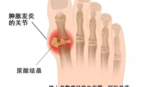 狂犬病人血液里有病毒吗-风干后的狂犬病人血液网狂犬病毒血液传播吗知识网站,分享狂犬病人的血液具有传染性吗大全